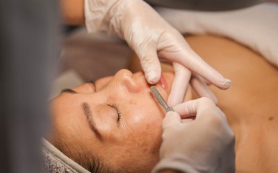 Dermaplaning uitgelegd