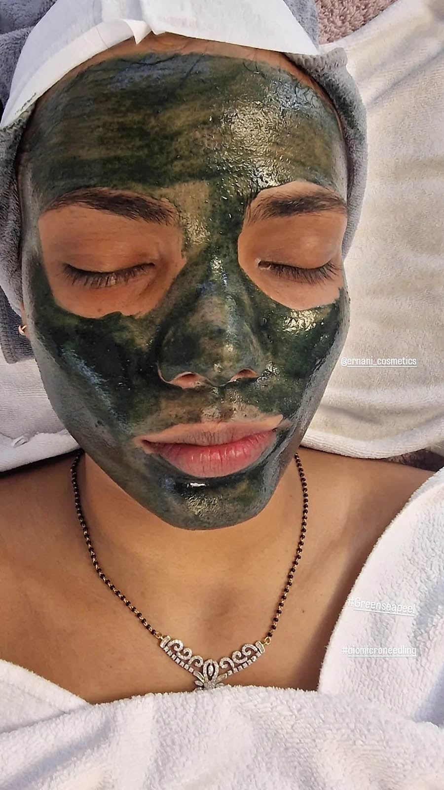 bio peeling green sea peel